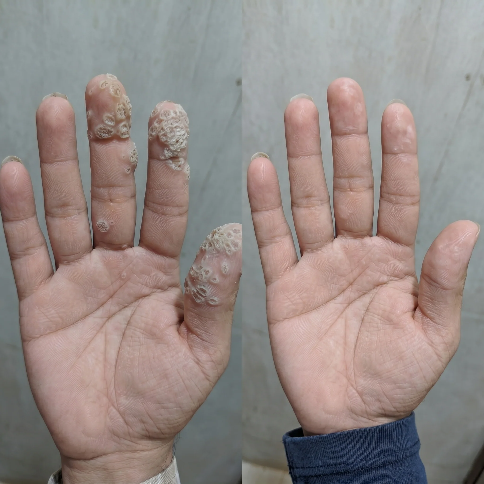 Olilos customer hand skin result