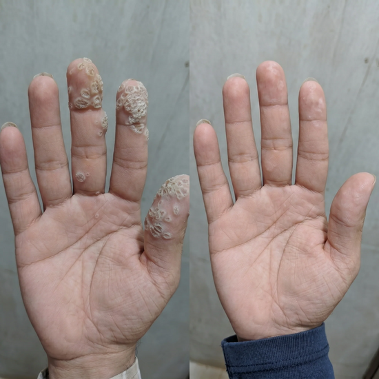 Before & After