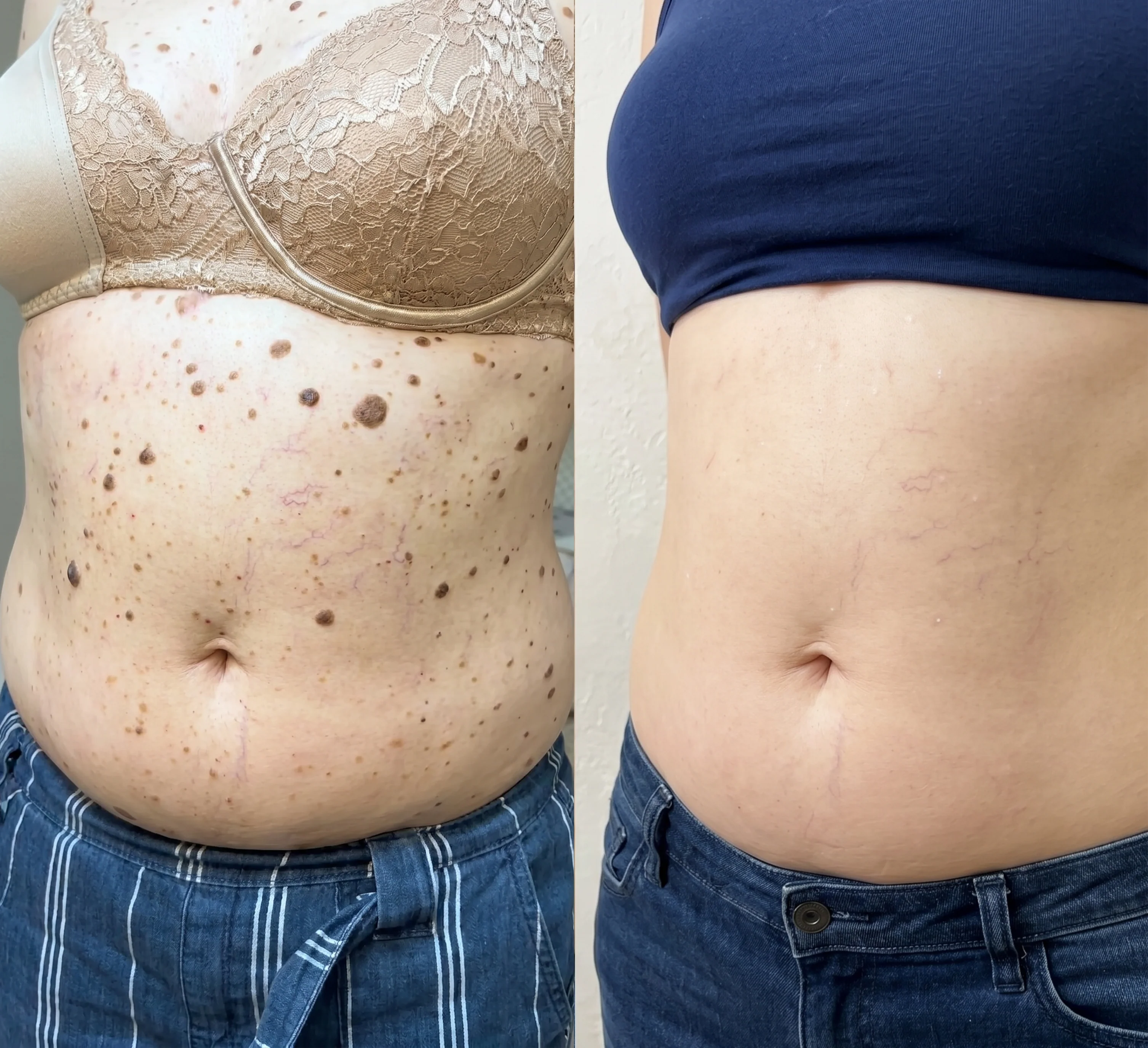 Olilos customer body skin result