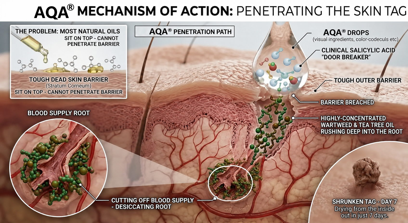 AQA mechanism of action
