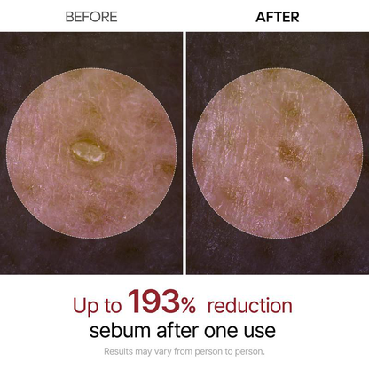 "Glow Naturally: Black Rice Serum for Radiant, Healthy-Looking Skin!"✨