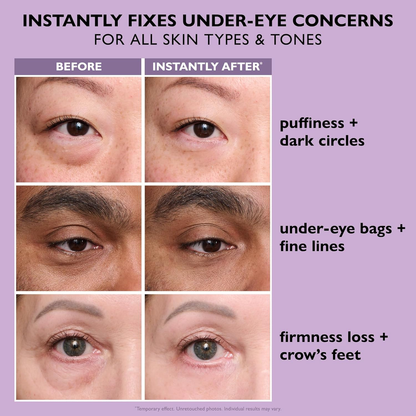 🔥Eye Bag Eraser