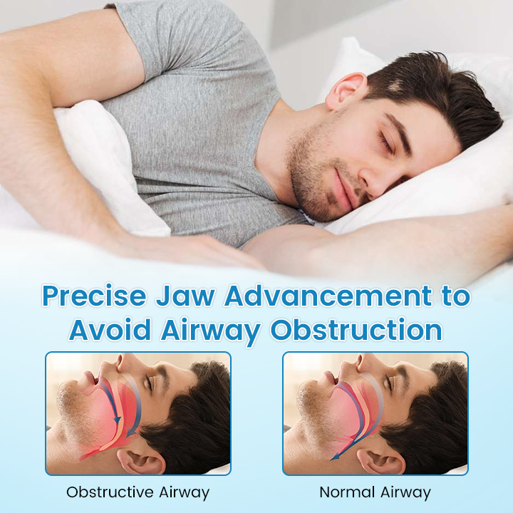 🌙🌙 SILENT NIGHTS, STRONG TEETH! 🦷 QIAWI™ Anti-Snoring Guard
