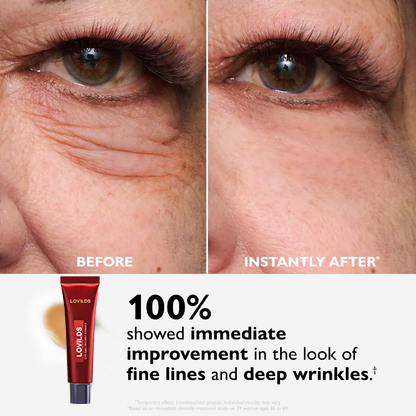 🔥Eye Bag Eraser